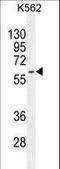 Keratin 73 antibody, LS-C165635, Lifespan Biosciences, Western Blot image 