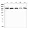 Eukaryotic Translation Initiation Factor 4 Gamma 1 antibody, A01351-2, Boster Biological Technology, Western Blot image 