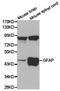 GFAP antibody, TA326789, Origene, Western Blot image 