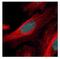 Zinc Finger And SCAN Domain Containing 21 antibody, NBP2-20944, Novus Biologicals, Immunofluorescence image 