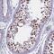 ALG10 Alpha-1,2-Glucosyltransferase antibody, NBP2-14281, Novus Biologicals, Immunohistochemistry paraffin image 