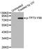 Tumor Protein P73 antibody, TA333303, Origene, Western Blot image 