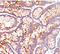Carcinoembryonic Antigen Related Cell Adhesion Molecule 5 antibody, AM33276PU-S, Origene, Immunohistochemistry frozen image 