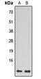 Ribosomal Protein L39 antibody, abx121714, Abbexa, Western Blot image 