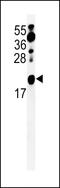 CCHC-Type Zinc Finger Nucleic Acid Binding Protein antibody, 61-662, ProSci, Western Blot image 