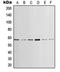 LCK Proto-Oncogene, Src Family Tyrosine Kinase antibody, orb214181, Biorbyt, Western Blot image 