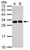 Solute Carrier Family 25 Member 11 antibody, NBP2-20385, Novus Biologicals, Western Blot image 