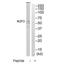 IKAROS Family Zinc Finger 2 antibody, TA315181, Origene, Western Blot image 