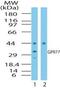 Complement Component 5a Receptor 2 antibody, PA1-41397, Invitrogen Antibodies, Western Blot image 