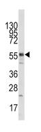 Lysine Acetyltransferase 5 antibody, abx025927, Abbexa, Western Blot image 