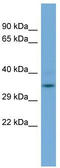 Glyoxalase Domain Containing 4 antibody, TA345069, Origene, Western Blot image 