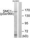 Structural Maintenance Of Chromosomes 1A antibody, LS-C199591, Lifespan Biosciences, Western Blot image 