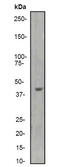 Actin Alpha Cardiac Muscle 1 antibody, TA303378, Origene, Western Blot image 