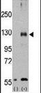 Transient receptor potential cation channel subfamily M member 8 antibody, PA5-15508, Invitrogen Antibodies, Western Blot image 