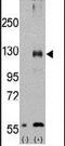 Transient Receptor Potential Cation Channel Subfamily M Member 8 antibody, PA5-15508, Invitrogen Antibodies, Western Blot image 