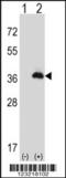 Peroxisomal Biogenesis Factor 16 antibody, 63-807, ProSci, Western Blot image 