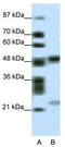 PHD Finger Protein 11 antibody, TA338331, Origene, Western Blot image 