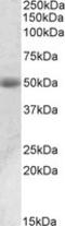 Acid Phosphatase, Prostate antibody, LS-B8361, Lifespan Biosciences, Western Blot image 