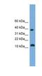 Protein LOC152586 antibody, NBP1-70604, Novus Biologicals, Western Blot image 