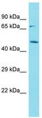 Carnosine N-Methyltransferase 1 antibody, TA333483, Origene, Western Blot image 