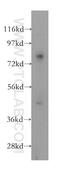 Gamma-Glutamyltransferase 5 antibody, 12002-1-AP, Proteintech Group, Western Blot image 