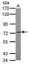 Serum/Glucocorticoid Regulated Kinase Family Member 3 antibody, PA5-29376, Invitrogen Antibodies, Western Blot image 