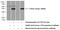 Cathepsin K antibody, 14296-1-AP, Proteintech Group, Western Blot image 