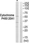 Cytochrome P450 Family 20 Subfamily A Member 1 antibody, TA315658, Origene, Western Blot image 