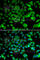 N(Alpha)-Acetyltransferase 10, NatA Catalytic Subunit antibody, A7009, ABclonal Technology, Immunofluorescence image 