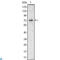 Proteinase 3 antibody, LS-C812749, Lifespan Biosciences, Western Blot image 