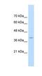 FKBP Prolyl Isomerase 6 antibody, NBP1-54606, Novus Biologicals, Western Blot image 