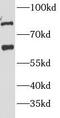 Purinergic Receptor P2X 4 antibody, FNab06069, FineTest, Western Blot image 
