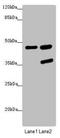 Serpin Family B Member 6 antibody, LS-C676470, Lifespan Biosciences, Western Blot image 