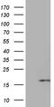 HERV-H LTR-Associating 3 antibody, M17800, Boster Biological Technology, Western Blot image 