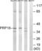Pre-MRNA Processing Factor 18 antibody, LS-C120244, Lifespan Biosciences, Western Blot image 