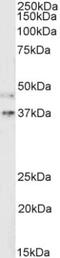 ATPase H+ Transporting Accessory Protein 2 antibody, NB100-1318, Novus Biologicals, Western Blot image 