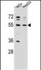 Asparaginyl-TRNA Synthetase antibody, PA5-48120, Invitrogen Antibodies, Western Blot image 