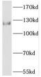 Phosphorylase Kinase Regulatory Subunit Beta antibody, FNab06393, FineTest, Western Blot image 