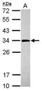 Purine Nucleoside Phosphorylase antibody, NBP2-19603, Novus Biologicals, Western Blot image 