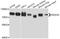 DEAD-Box Helicase 3 X-Linked antibody, STJ112138, St John
