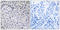 Zeta Chain Of T Cell Receptor Associated Protein Kinase 70 antibody, LS-C199742, Lifespan Biosciences, Immunohistochemistry paraffin image 