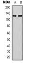 EPH Receptor A4 antibody, orb318916, Biorbyt, Western Blot image 