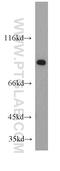 Zinc Finger Protein 839 antibody, 20539-1-AP, Proteintech Group, Western Blot image 