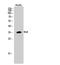 Serine And Arginine Rich Splicing Factor 7 antibody, STJ91393, St John