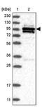 OTU Deubiquitinase 7B antibody, PA5-55495, Invitrogen Antibodies, Western Blot image 