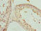 PHD Finger Protein 13 antibody, orb25326, Biorbyt, Immunohistochemistry paraffin image 