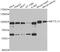 EEF1A Lysine And N-Terminal Methyltransferase antibody, STJ29191, St John