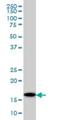 Ubiquitin Conjugating Enzyme E2 G2 antibody, H00007327-M01, Novus Biologicals, Western Blot image 