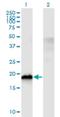 Cold Inducible RNA Binding Protein antibody, H00001153-M03, Novus Biologicals, Western Blot image 