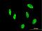 Nudix Hydrolase 21 antibody, H00011051-M12, Novus Biologicals, Immunofluorescence image 